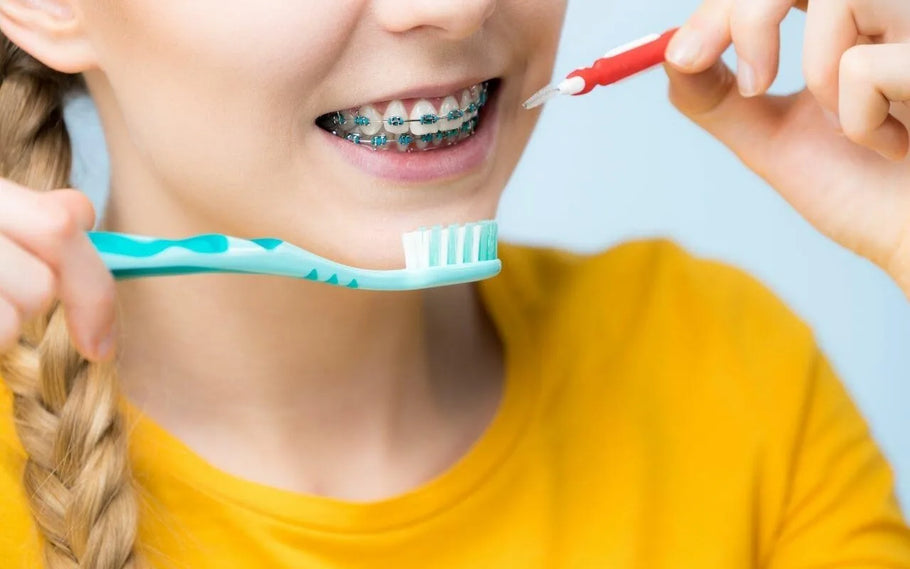 ¿Te limpian los dientes antes de ponerte los brackets y tiene importancia?