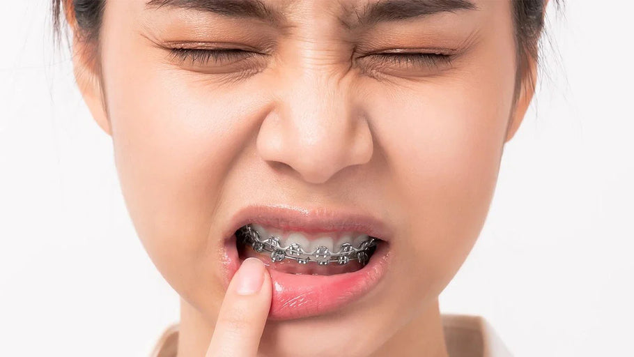 ¿Duelen los Brackets? Qué Esperar y Cómo Manejarlo