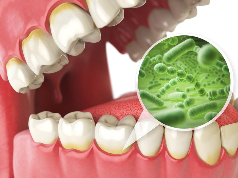 ¿Cuánto tiempo hasta que una infección dental mata a you?