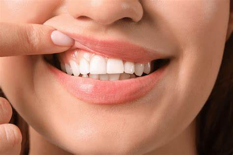 Mejor cepillo de dientes electrico para encías retraídas