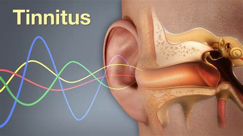 ¿Pueden los cepillos de dientes sónicos causar tinnitus?