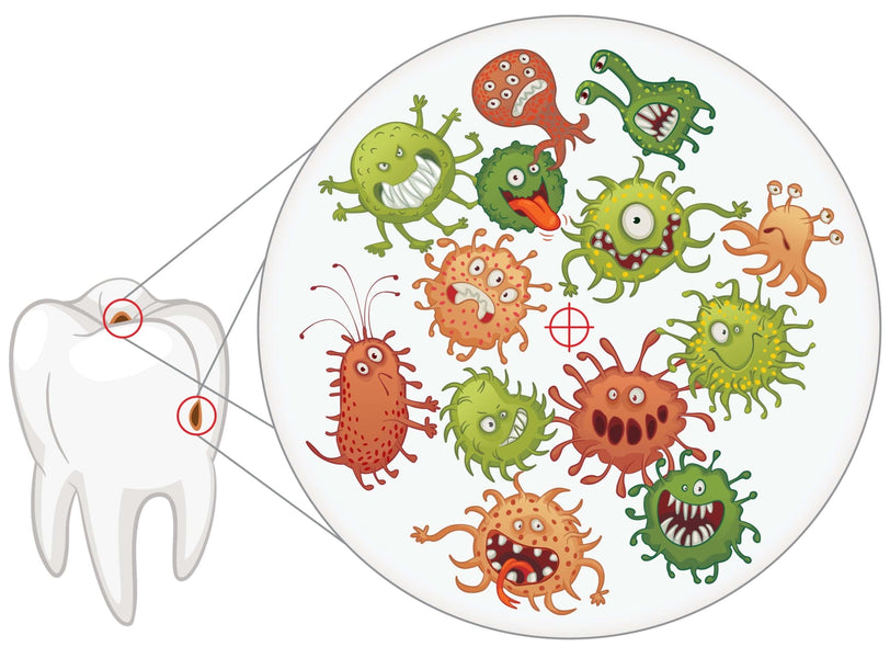 ¿Cuánto tiempo puede pasar sin tratar una infección dental?