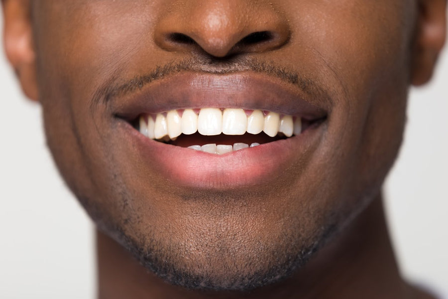 ¿Son los dientes huesos?