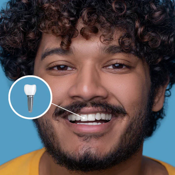 ¿Por qué no lácteos después de un implante dental?