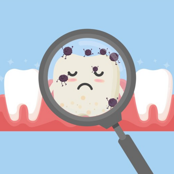 El Antibiótico Natural Más Fuerte para la Infección Dental: Remedios Efectivos y Prevención