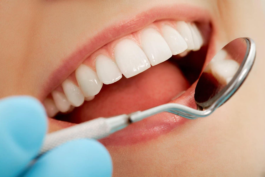 Limpieza Dental Para Una Sonrisa Radiante: En Qué Consiste, Riesgos Y Beneficios