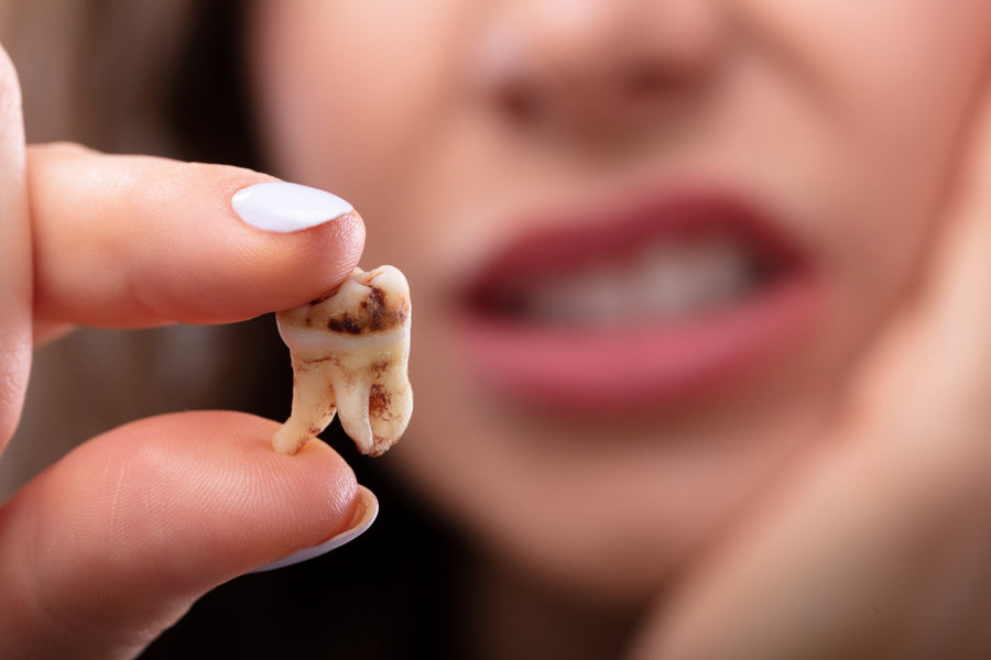 ¿Cómo eliminar la caries dental por uno mismo?